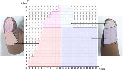 Electrical nerve stimulation for sensory-neural pathway reconstruction in upper-limb amputees